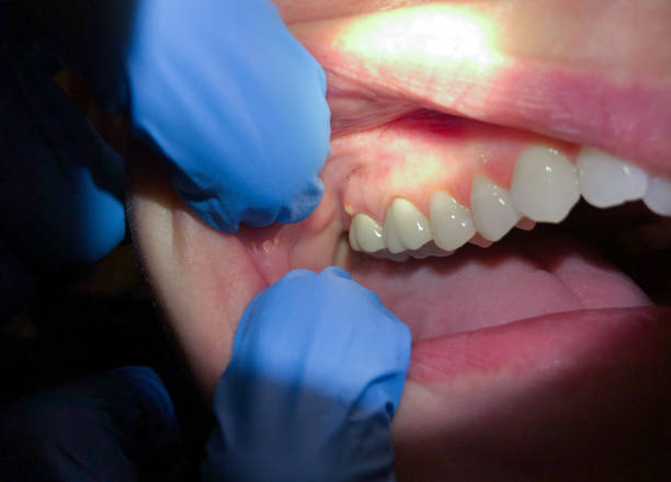 Best Emergency Denture Repair in Bellemont, AZ