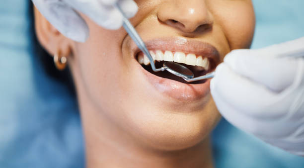 Best Emergency Dental Care for Broken or Chipped Teeth in Bellemont, AZ